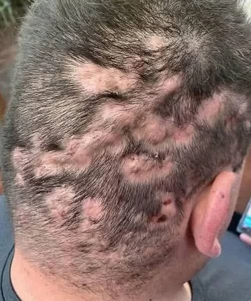 Preventive Health Guide: Spotting the First Signs of Trouble