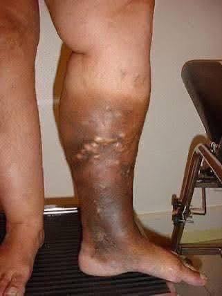 HT2. These are the first symptoms of a… See more