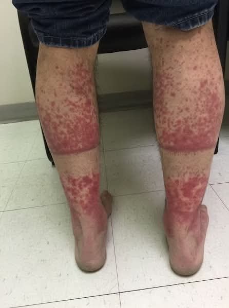 STAY AWAY THE DEVASTATING HIDDEN CONSEQUENCES OF SLEEPING WITH THE WRONG PERSON