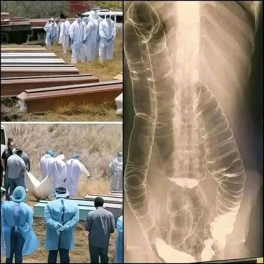 Public Health, Disease, and Medical Imaging: Understanding the Link Between Illness and Mortality